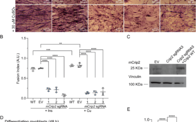 Cysteine Rich Intestinal Protein 2 is a copper-responsive regulator of skeletal muscle differentiation and metal homeostasis