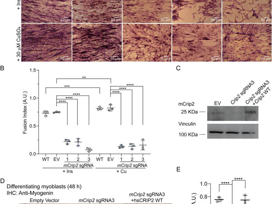 Cysteine Rich Intestinal Protein 2 is a copper-responsive regulator of skeletal muscle differentiation and metal homeostasis