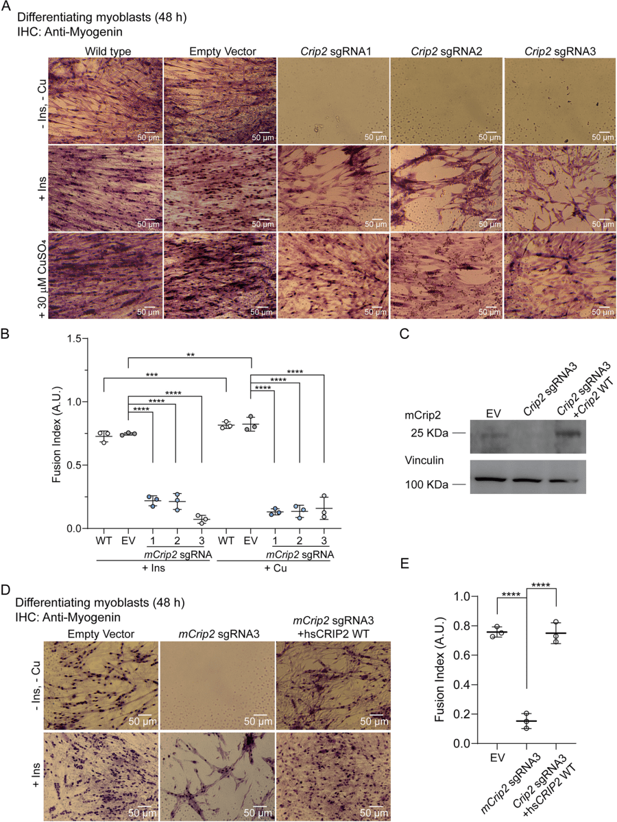 Cysteine Rich Intestinal Protein 2 is a copper-responsive regulator of skeletal muscle differentiation and metal homeostasis